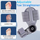 Bunion Toe Valgus Corrector / 50% OFF Today Only!